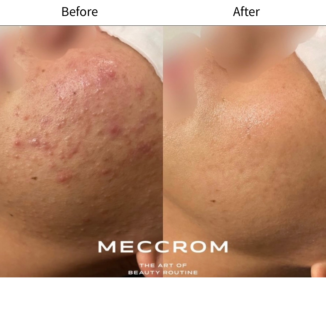 피부 컨디션 회복